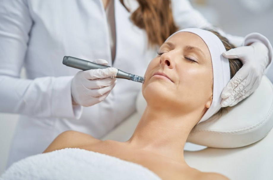 microneedling plymouth