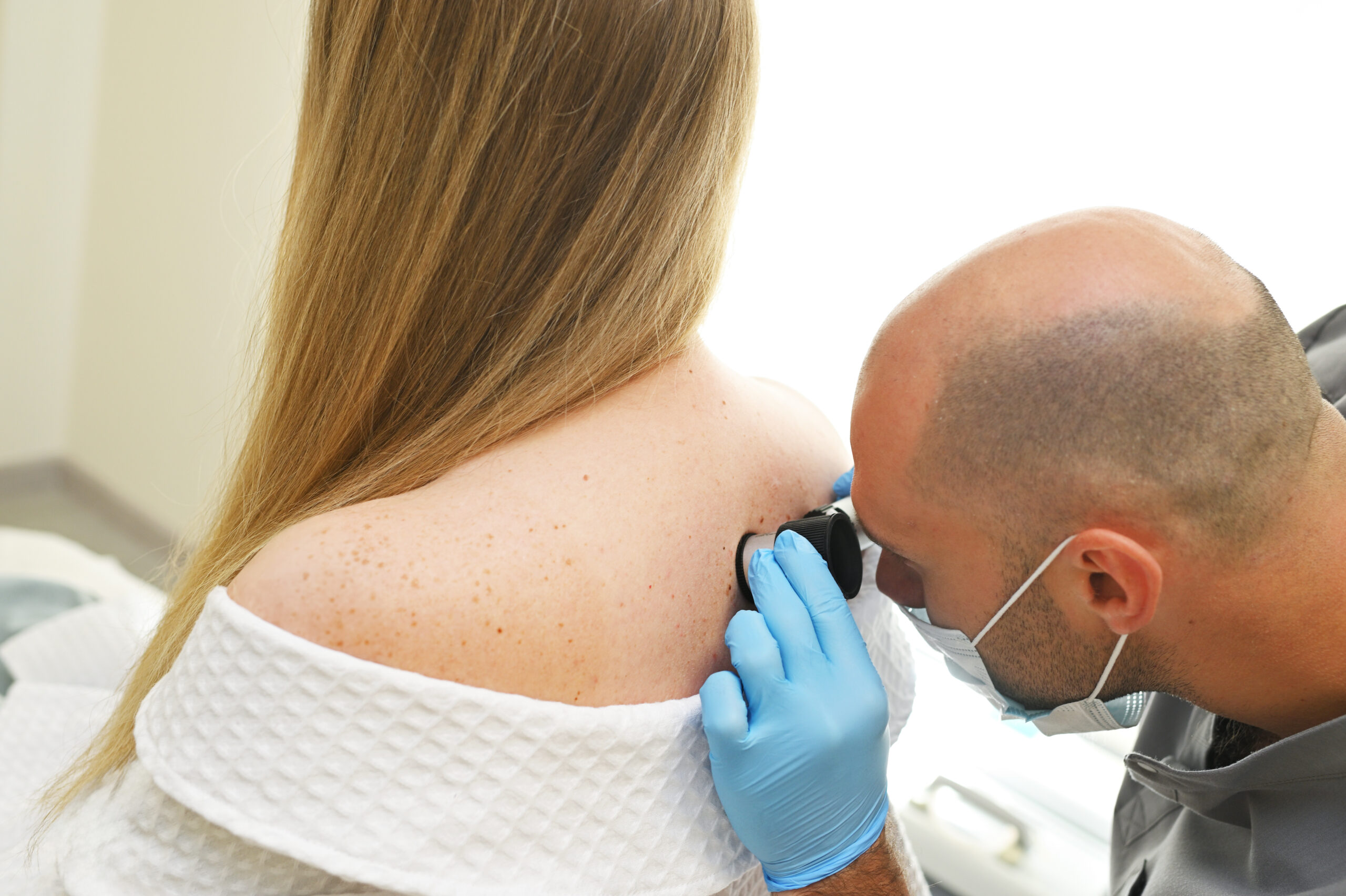 A dermatologist examines neoplasms on the patient's skin using a special dermatoscope device. Prevention of melanoma.